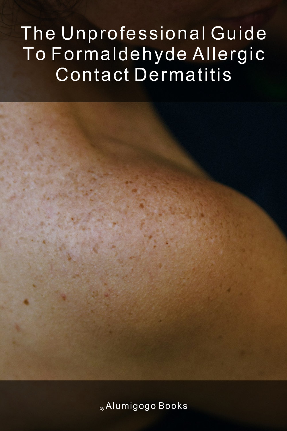 Cover of The Unprofessional Guide to formaldehyde allergic contact dermatitis