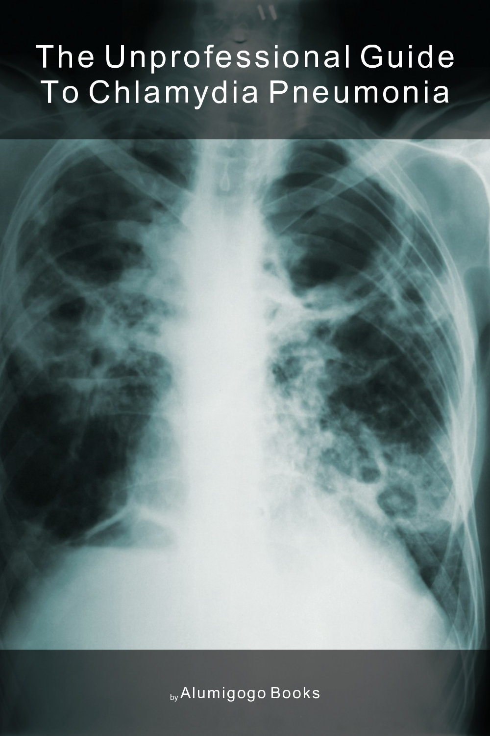 Cover of The Unprofessional Guide to Chlamydia pneumonia