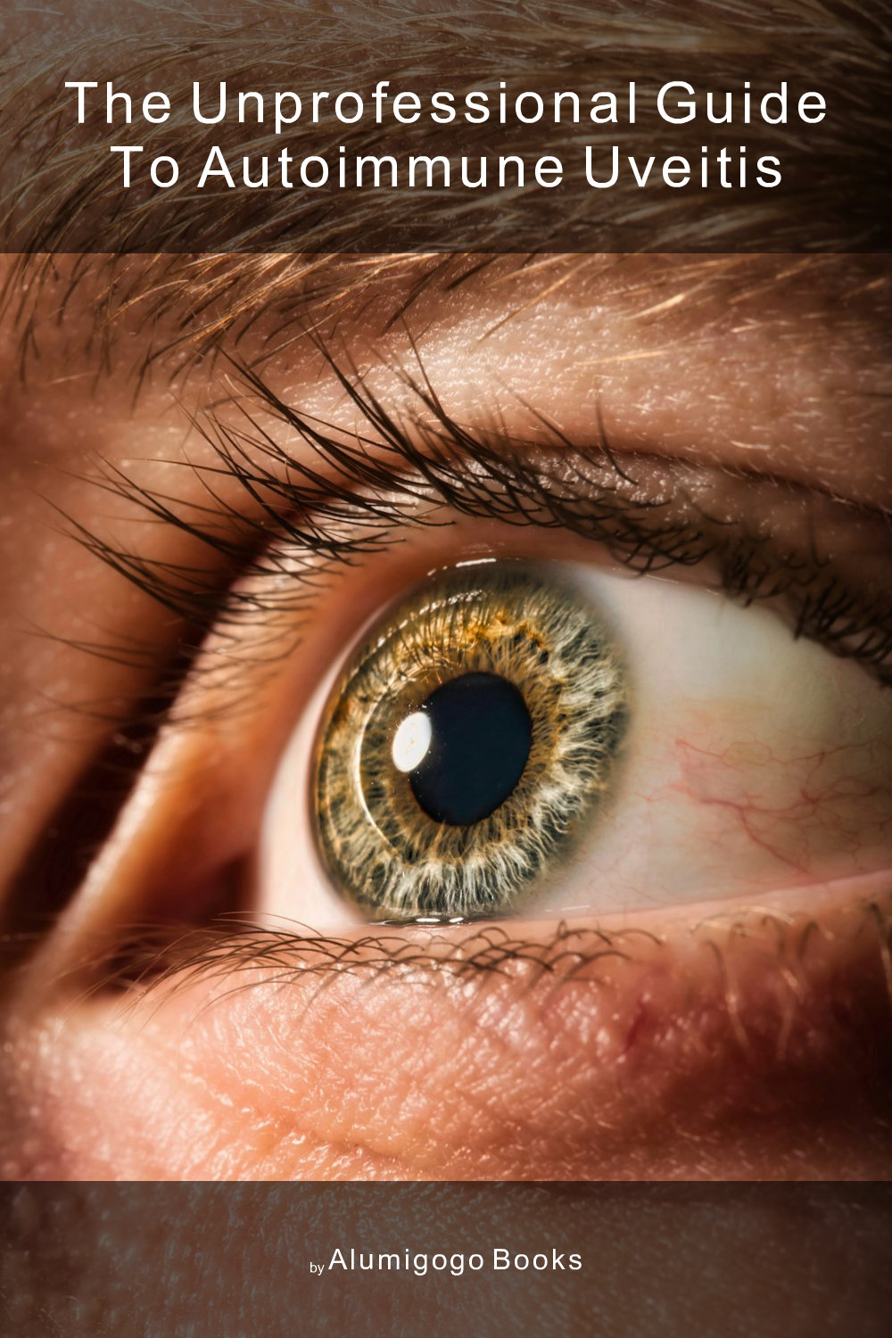 Cover of The Unprofessional Guide to autoimmune uveitis