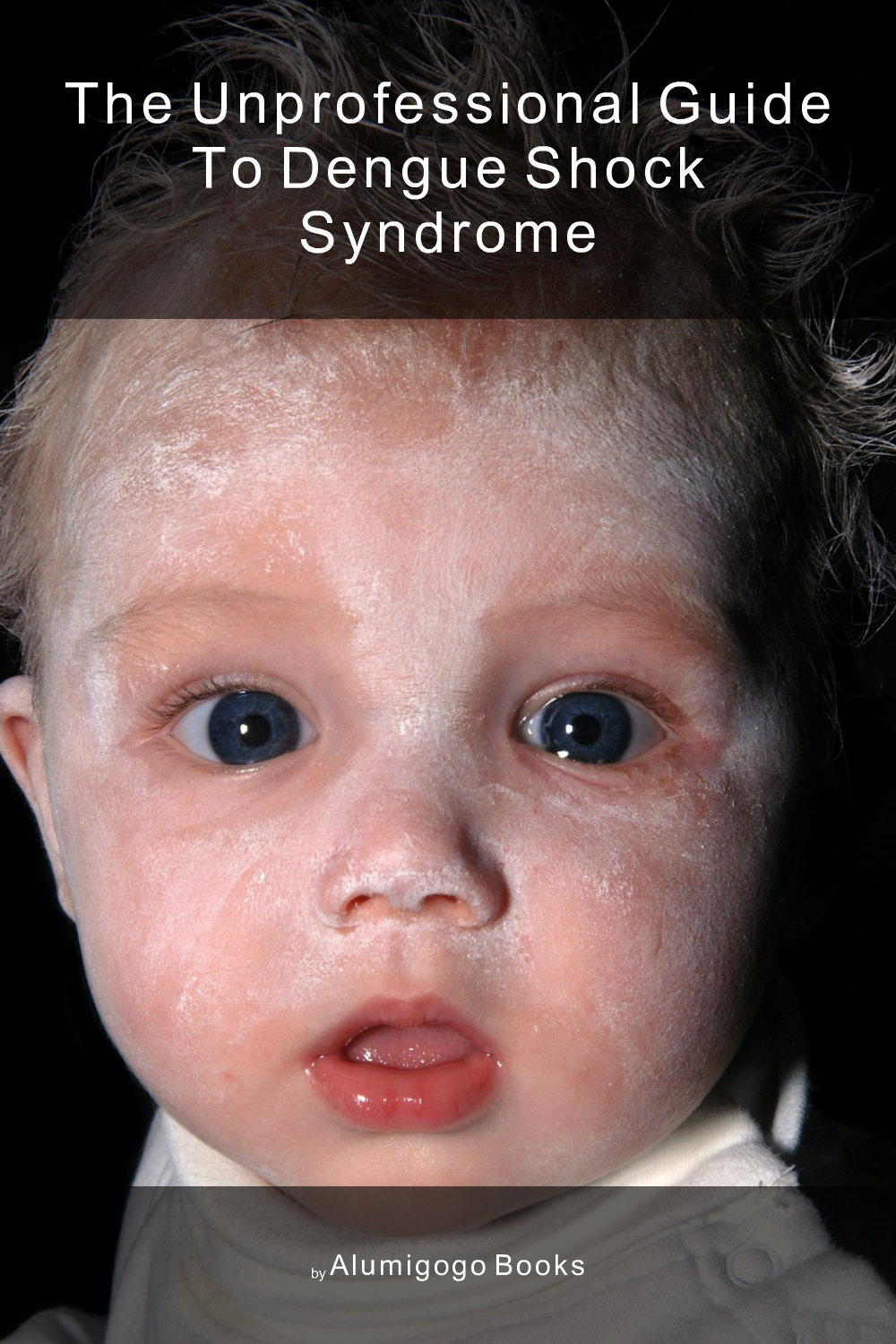 Cover of The Unprofessional Guide to dengue shock syndrome