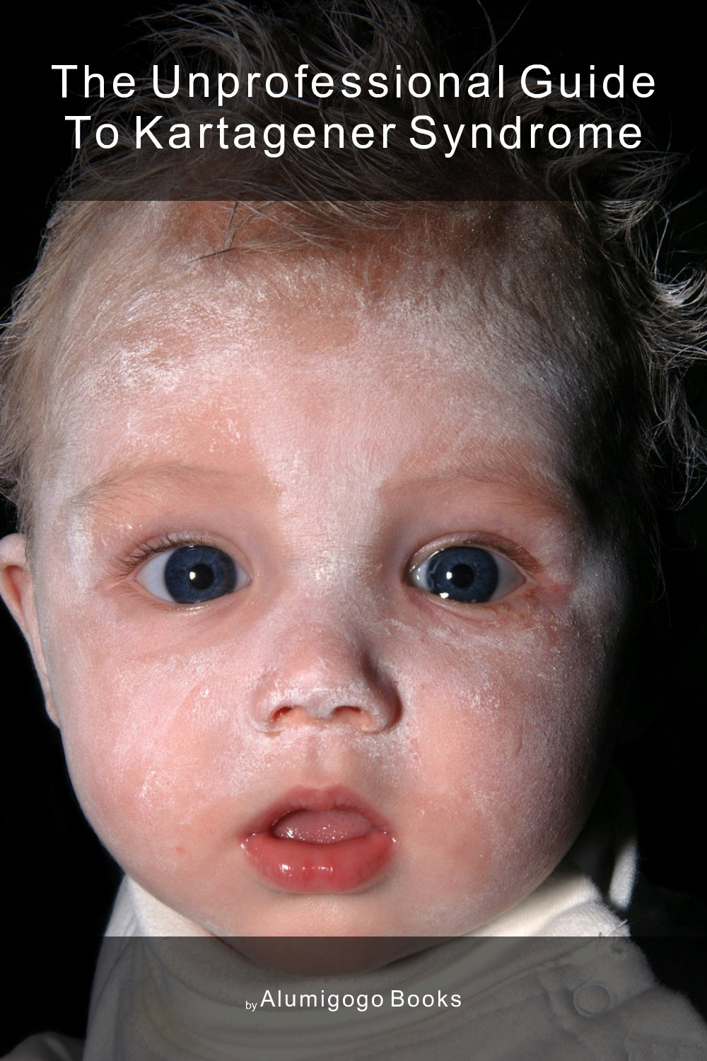 Cover of The Unprofessional Guide to Kartagener syndrome