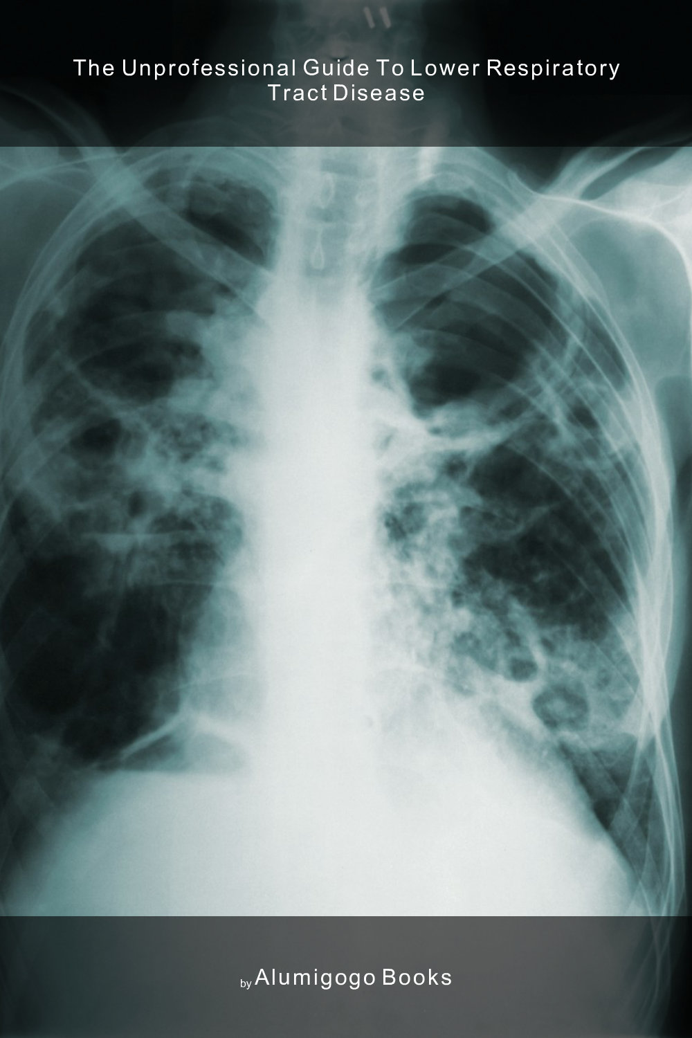 Cover of The Unprofessional Guide to lower respiratory tract disease