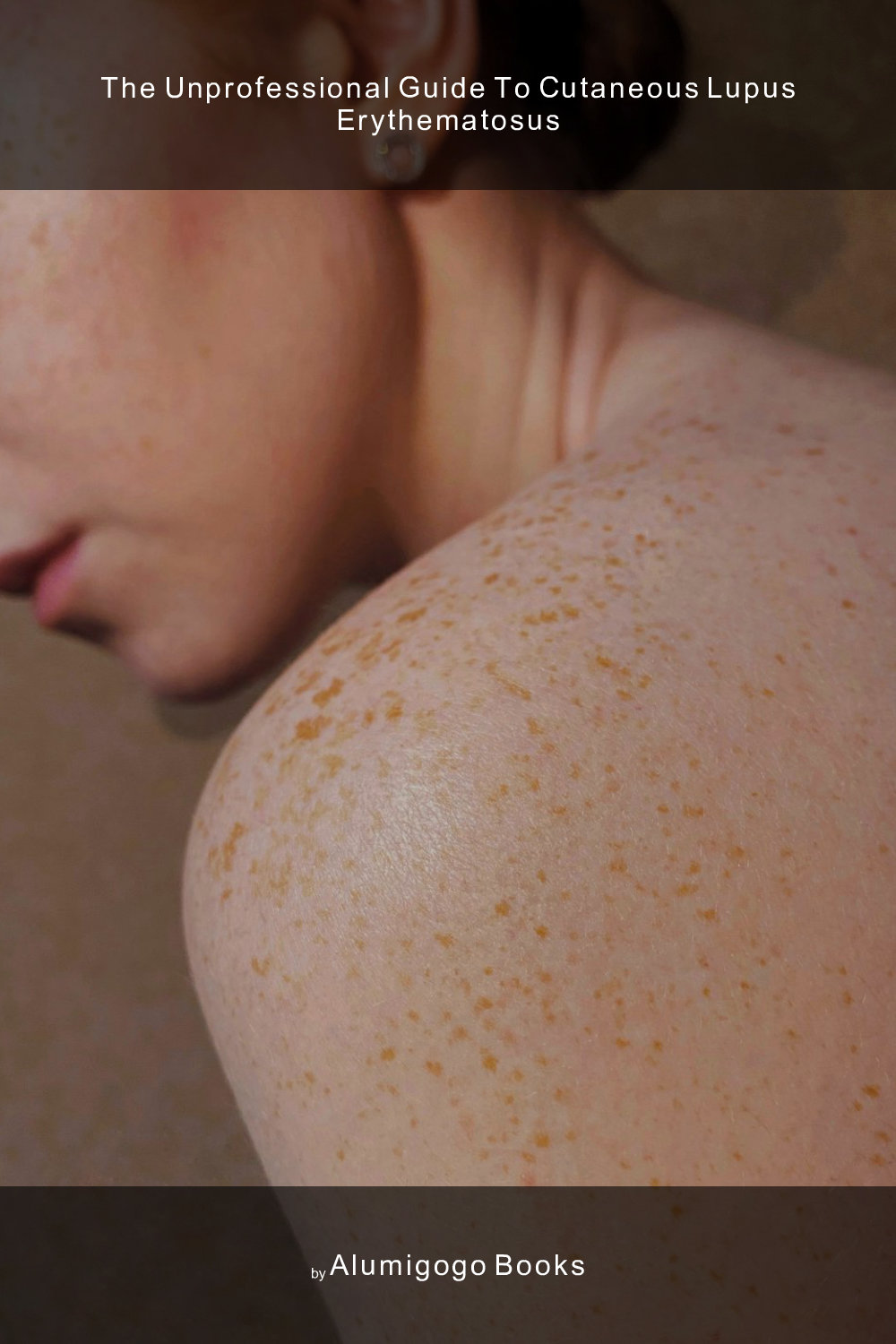 Cover of The Unprofessional Guide to cutaneous lupus erythematosus