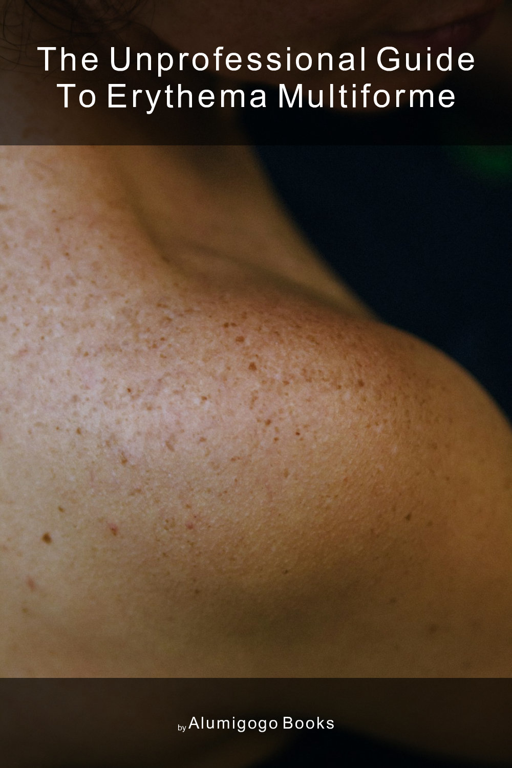 Cover of The Unprofessional Guide to erythema multiforme