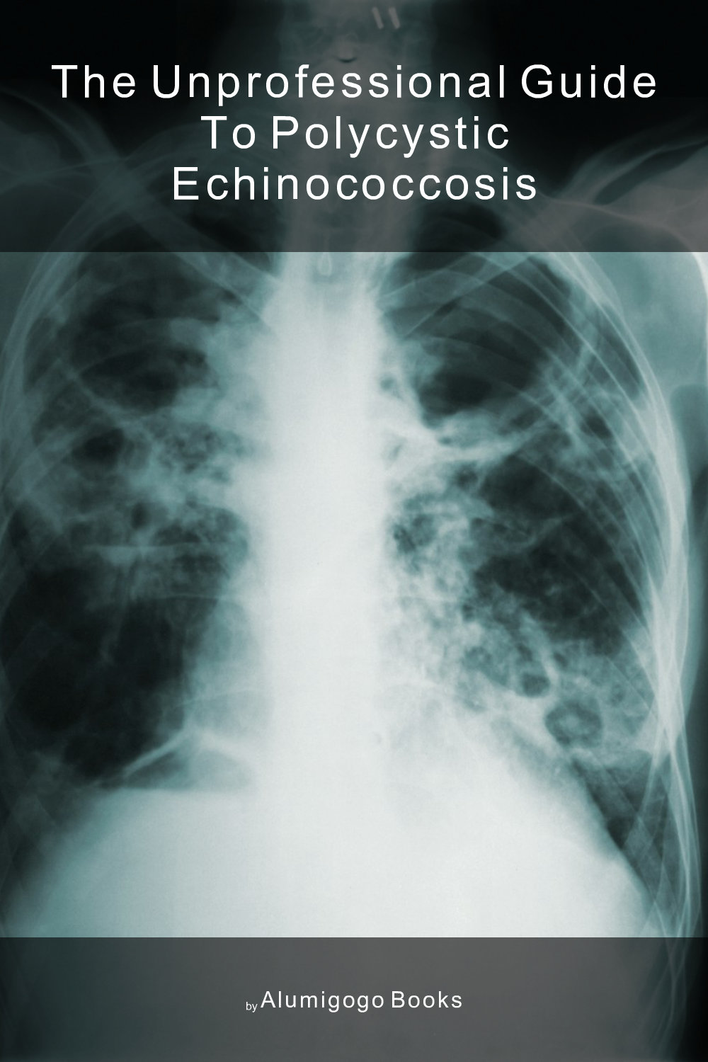 Cover of The Unprofessional Guide to polycystic echinococcosis