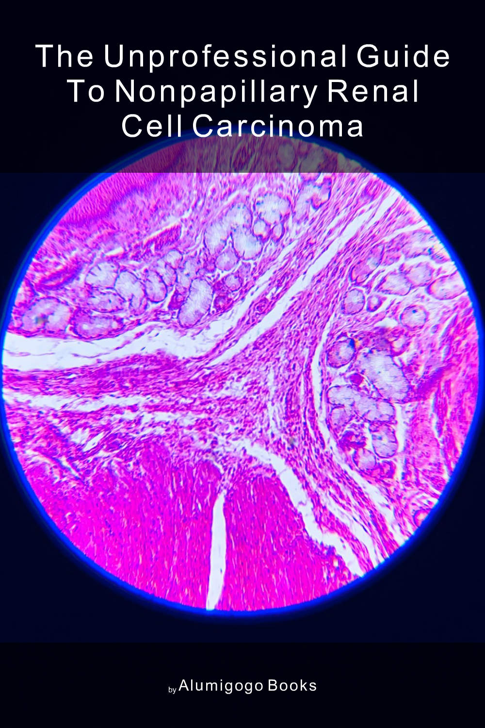 Cover of The Unprofessional Guide to nonpapillary renal cell carcinoma