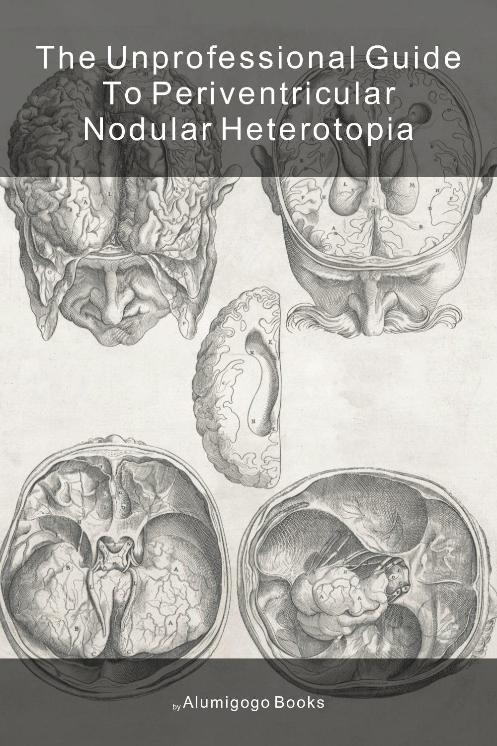 Cover of The Unprofessional Guide to periventricular nodular heterotopia