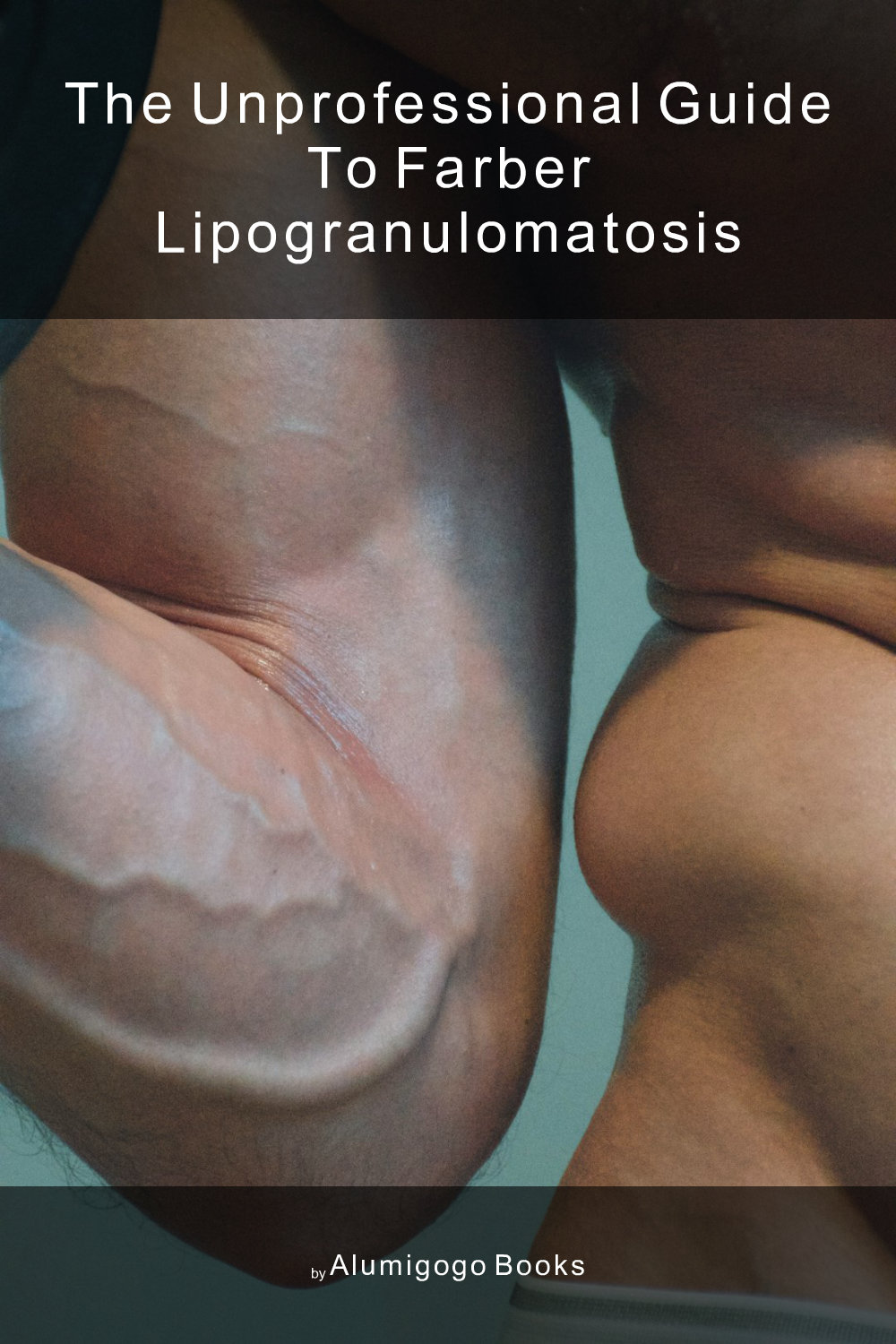 Cover of The Unprofessional Guide to Farber lipogranulomatosis