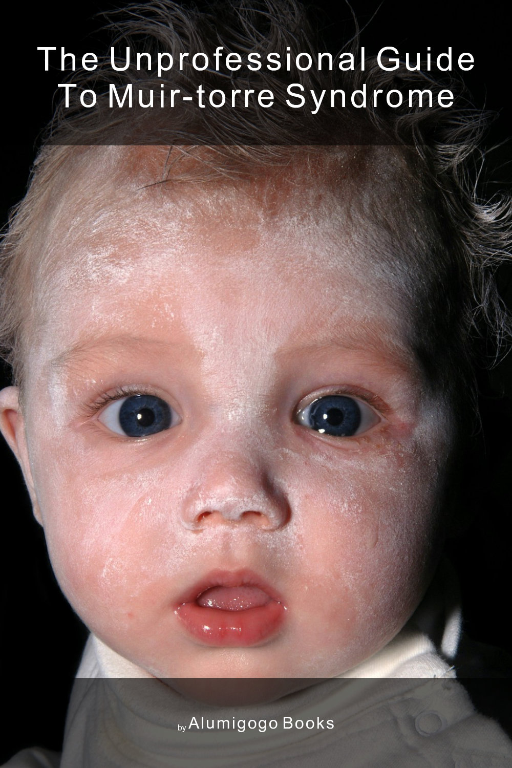 Cover of The Unprofessional Guide to Muir-Torre syndrome