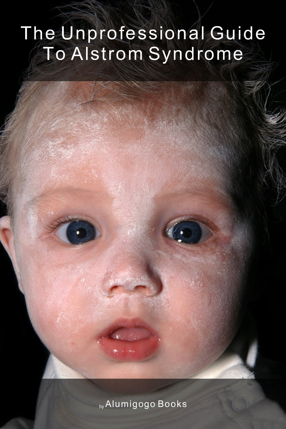 Cover of The Unprofessional Guide to Alstrom syndrome