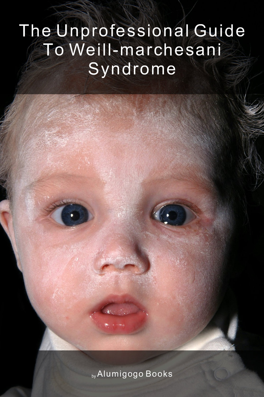 Cover of The Unprofessional Guide to Weill-Marchesani syndrome