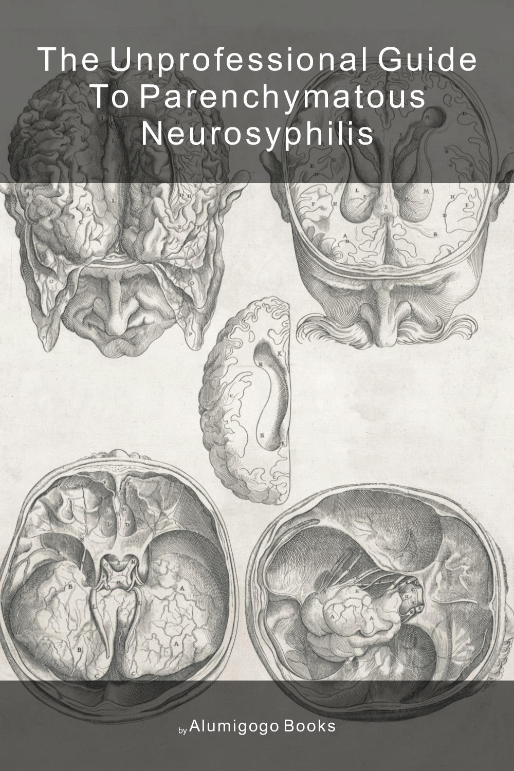 Cover of The Unprofessional Guide to parenchymatous neurosyphilis