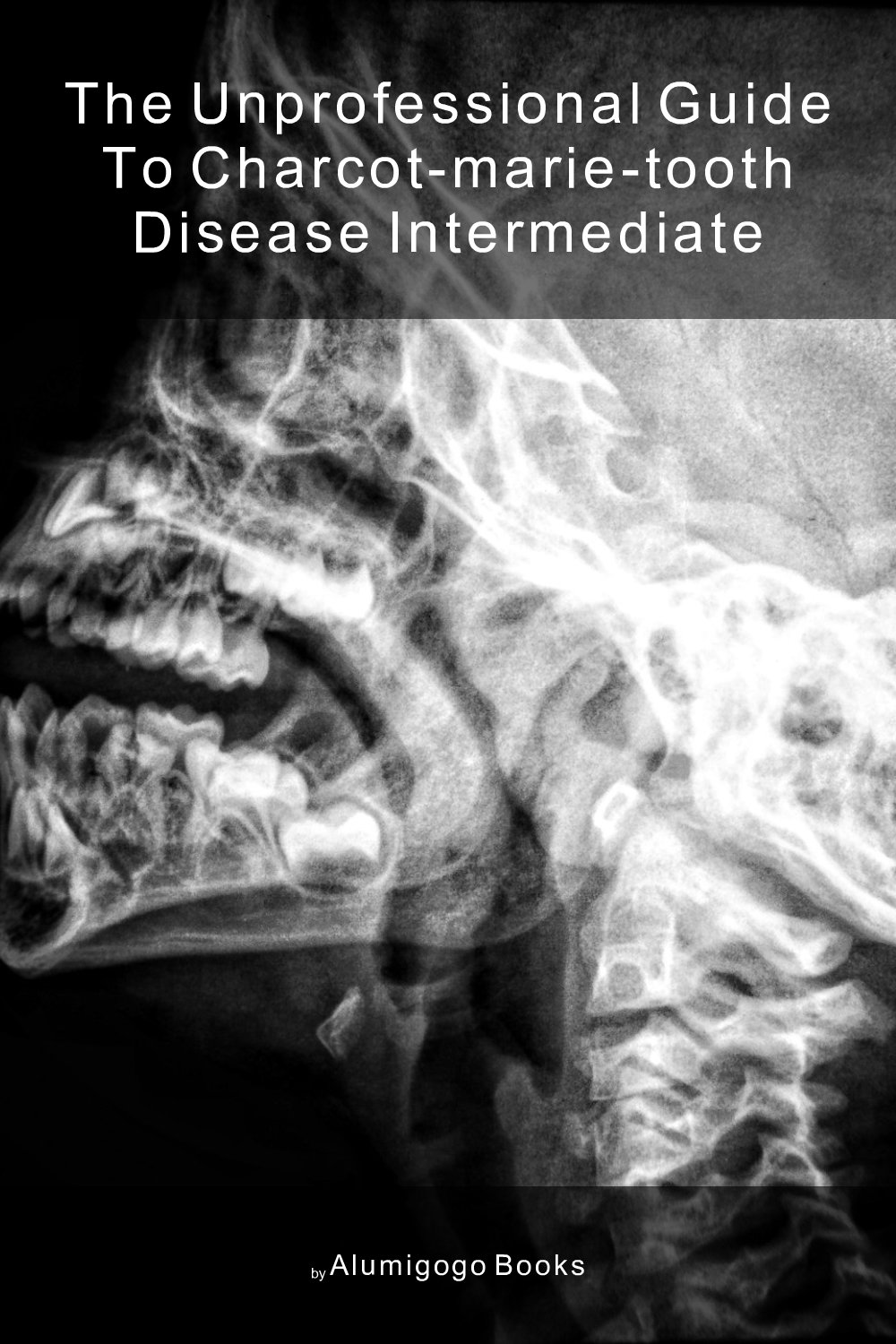 Cover of The Unprofessional Guide to Charcot-Marie-Tooth disease intermediate