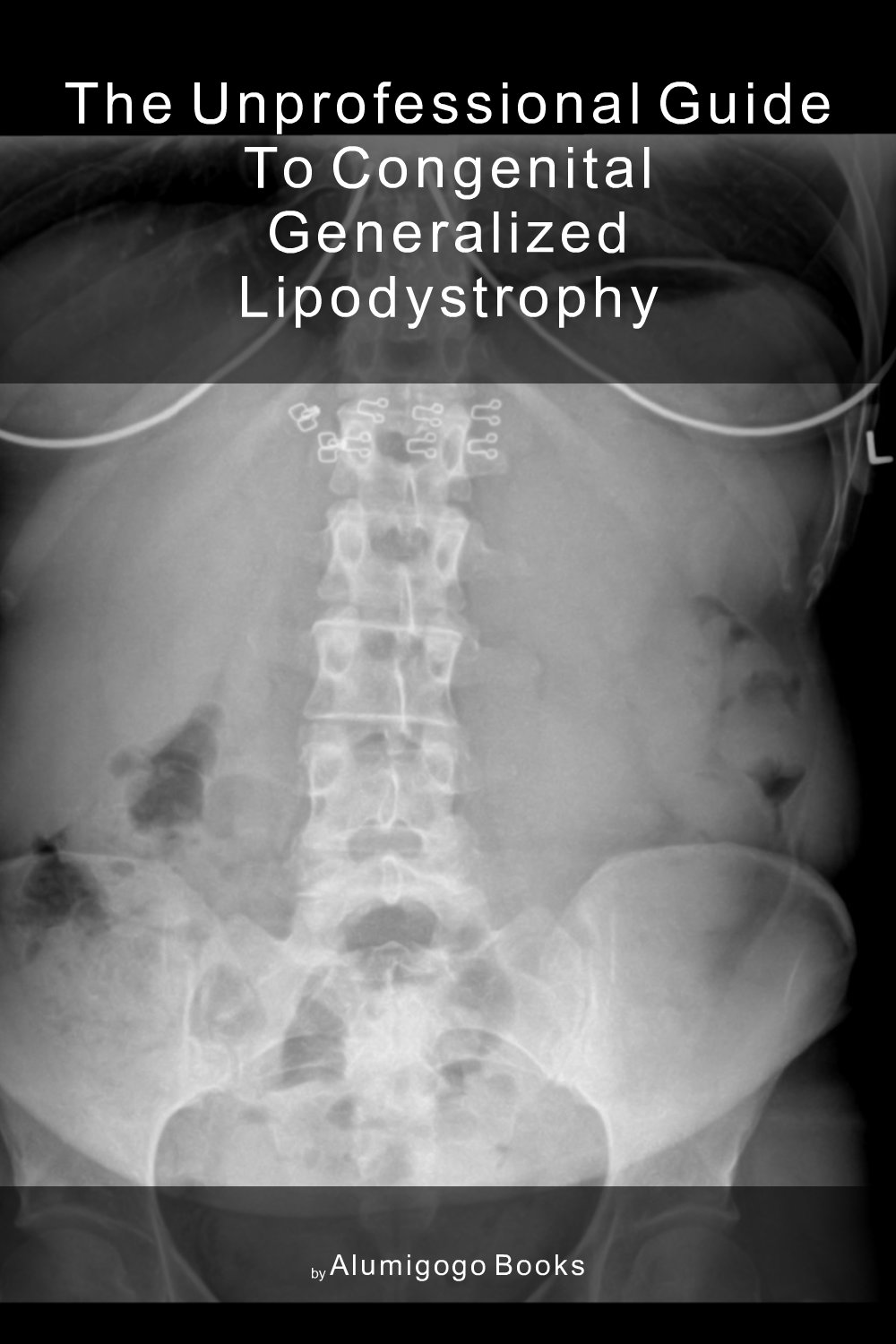 Cover of The Unprofessional Guide to congenital generalized lipodystrophy