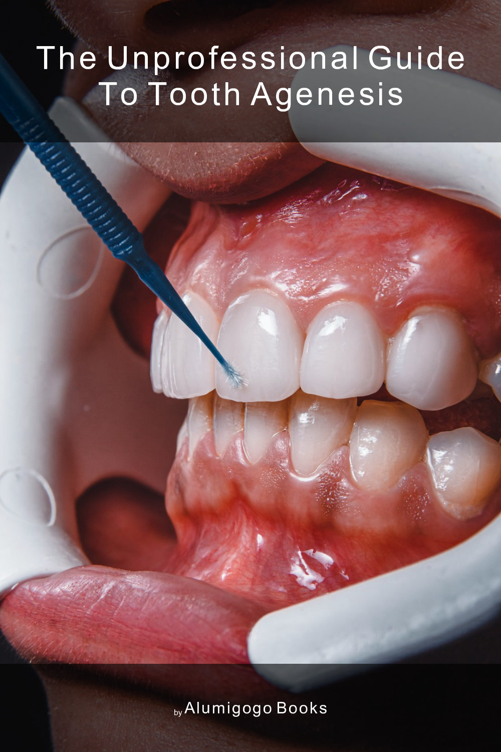 Cover of The Unprofessional Guide to tooth agenesis