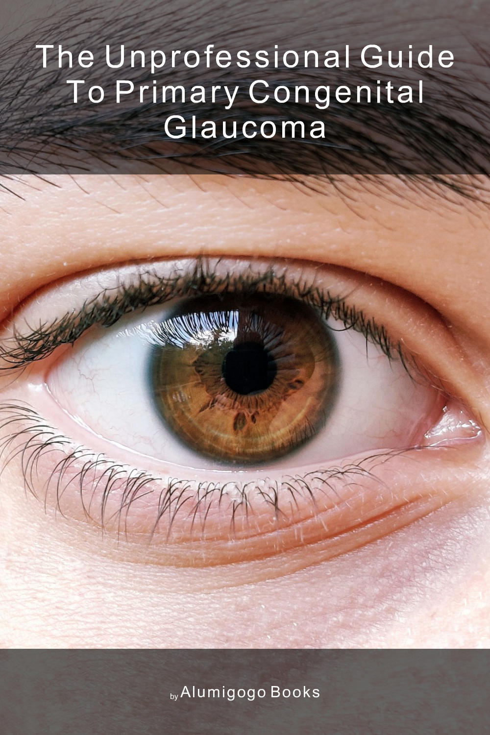 Cover of The Unprofessional Guide to primary congenital glaucoma