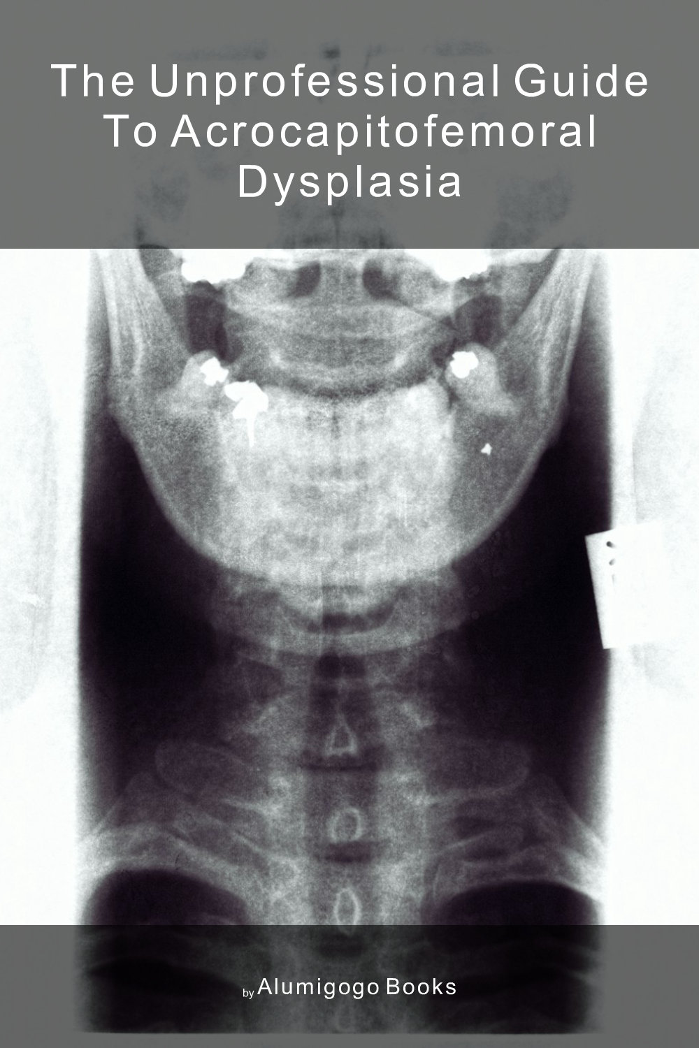 Cover of The Unprofessional Guide to acrocapitofemoral dysplasia