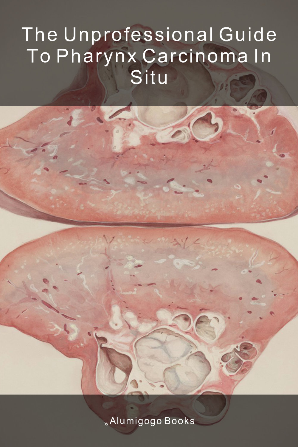 Cover of The Unprofessional Guide to pharynx carcinoma in situ