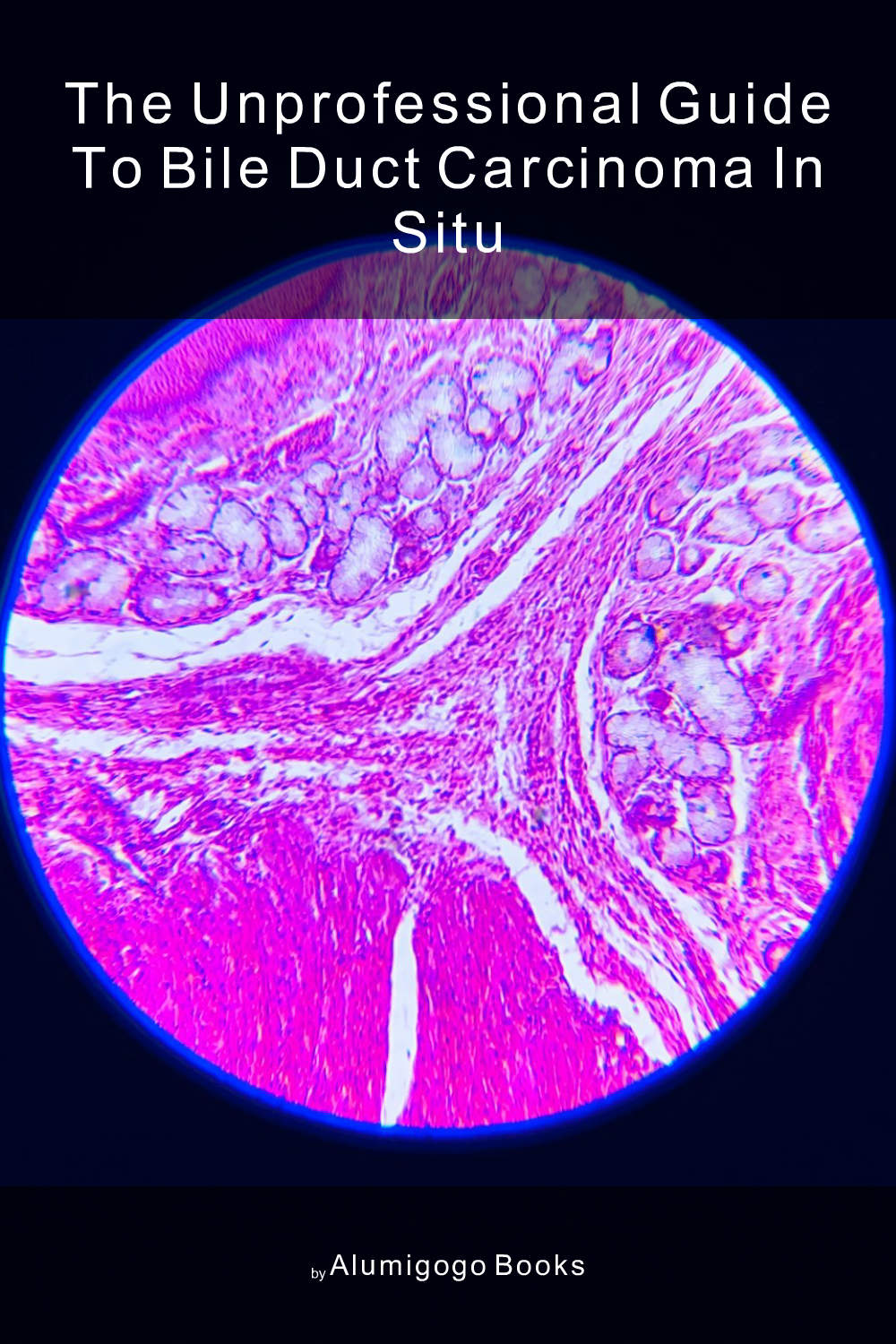 Cover of The Unprofessional Guide to bile duct carcinoma in situ