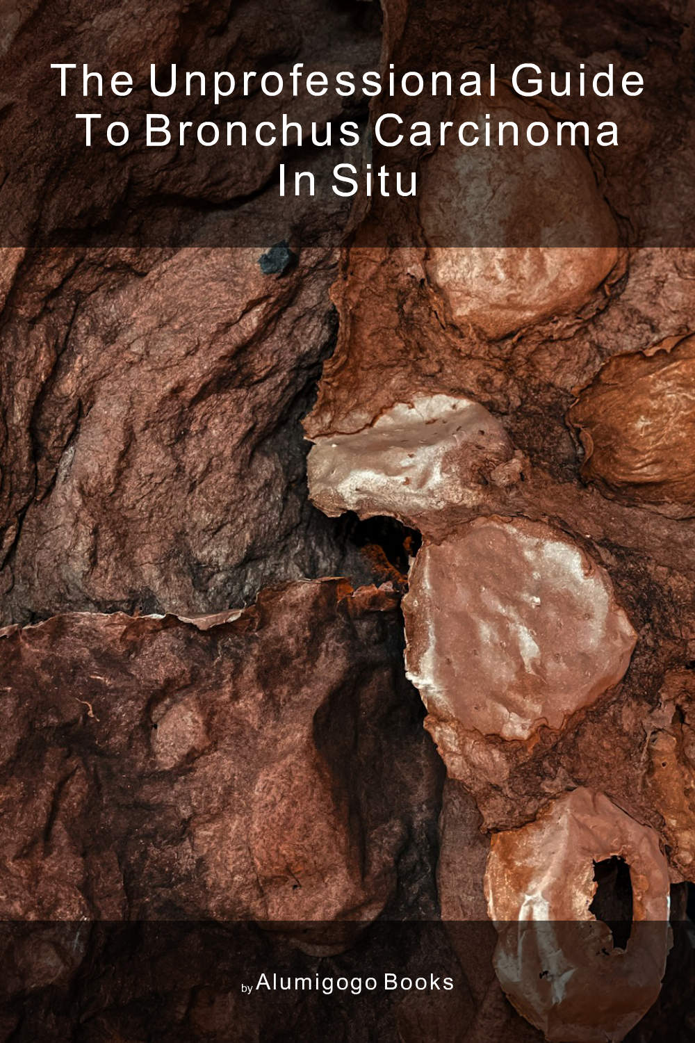 Cover of The Unprofessional Guide to bronchus carcinoma in situ
