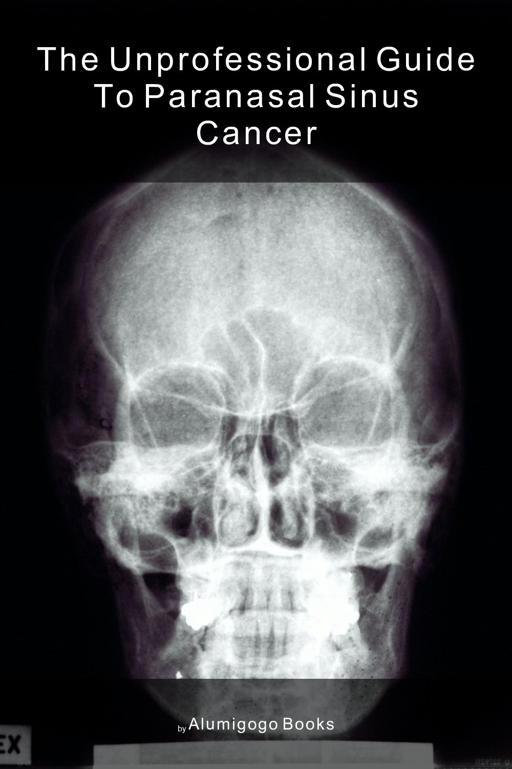 Cover of The Unprofessional Guide to paranasal sinus cancer