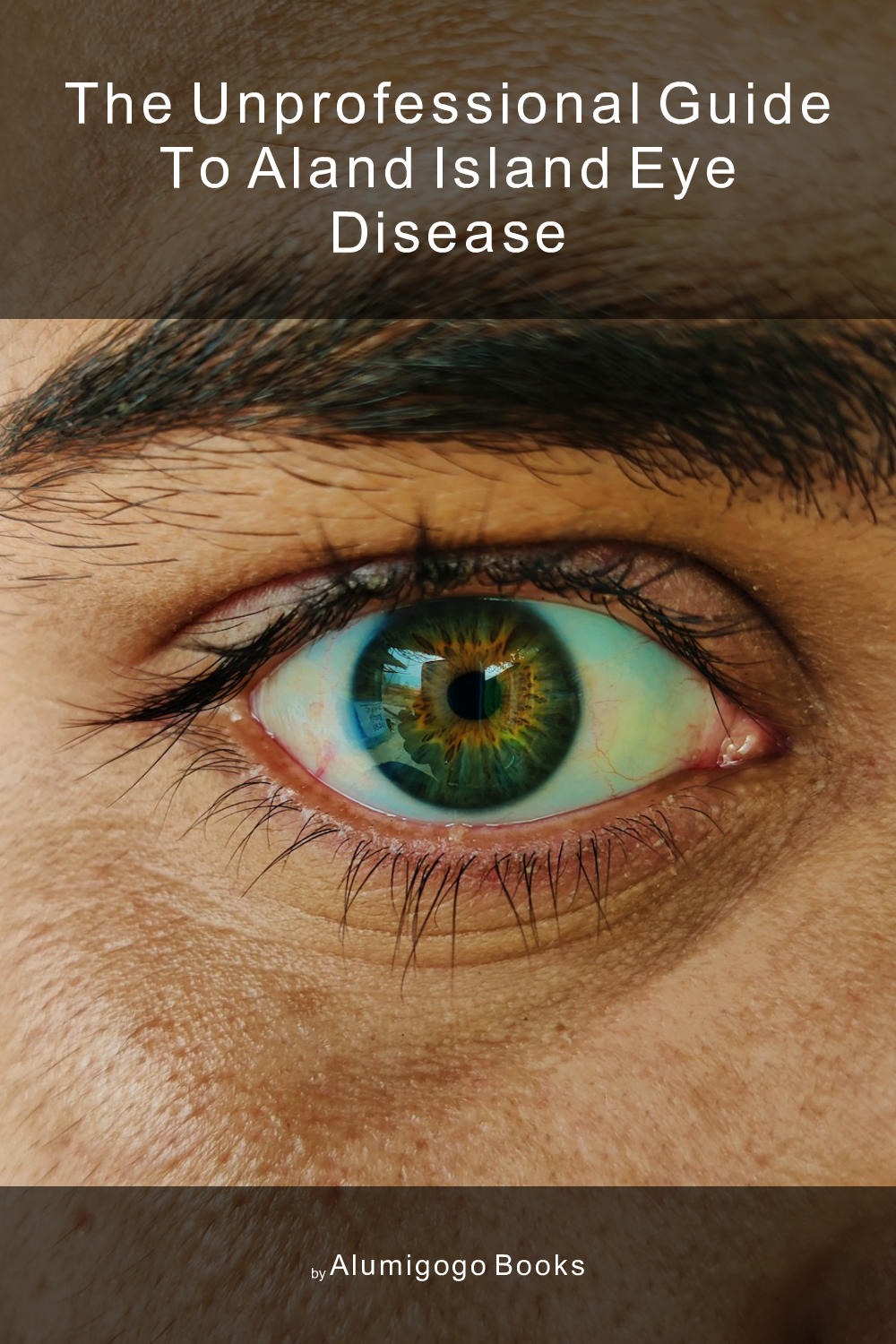 Cover of The Unprofessional Guide to Aland Island eye disease