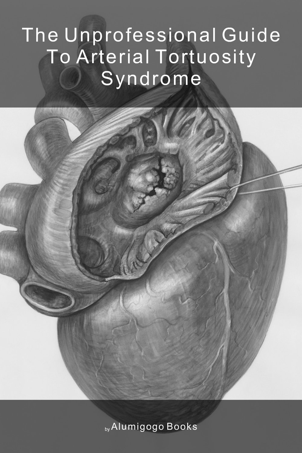 Cover of The Unprofessional Guide to arterial tortuosity syndrome