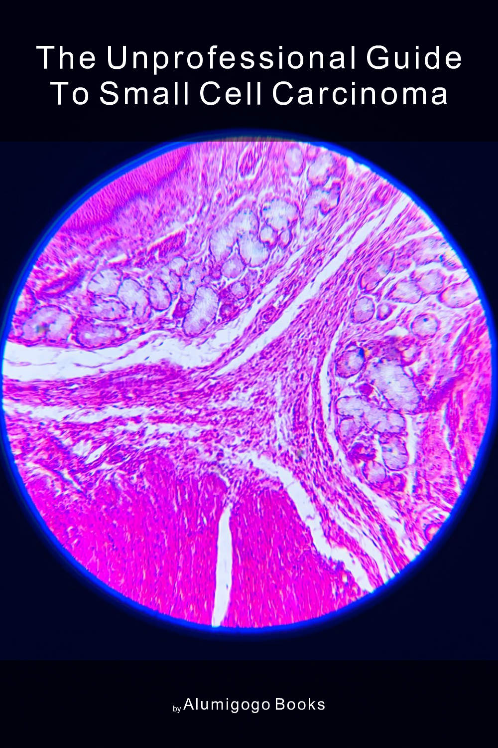 Cover of The Unprofessional Guide to small cell carcinoma