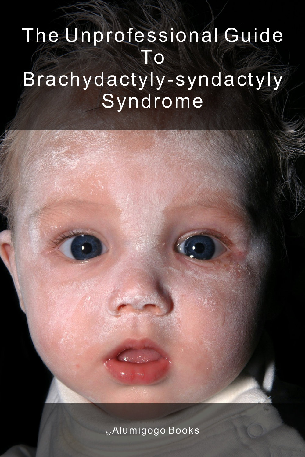 Cover of The Unprofessional Guide to brachydactyly-syndactyly syndrome