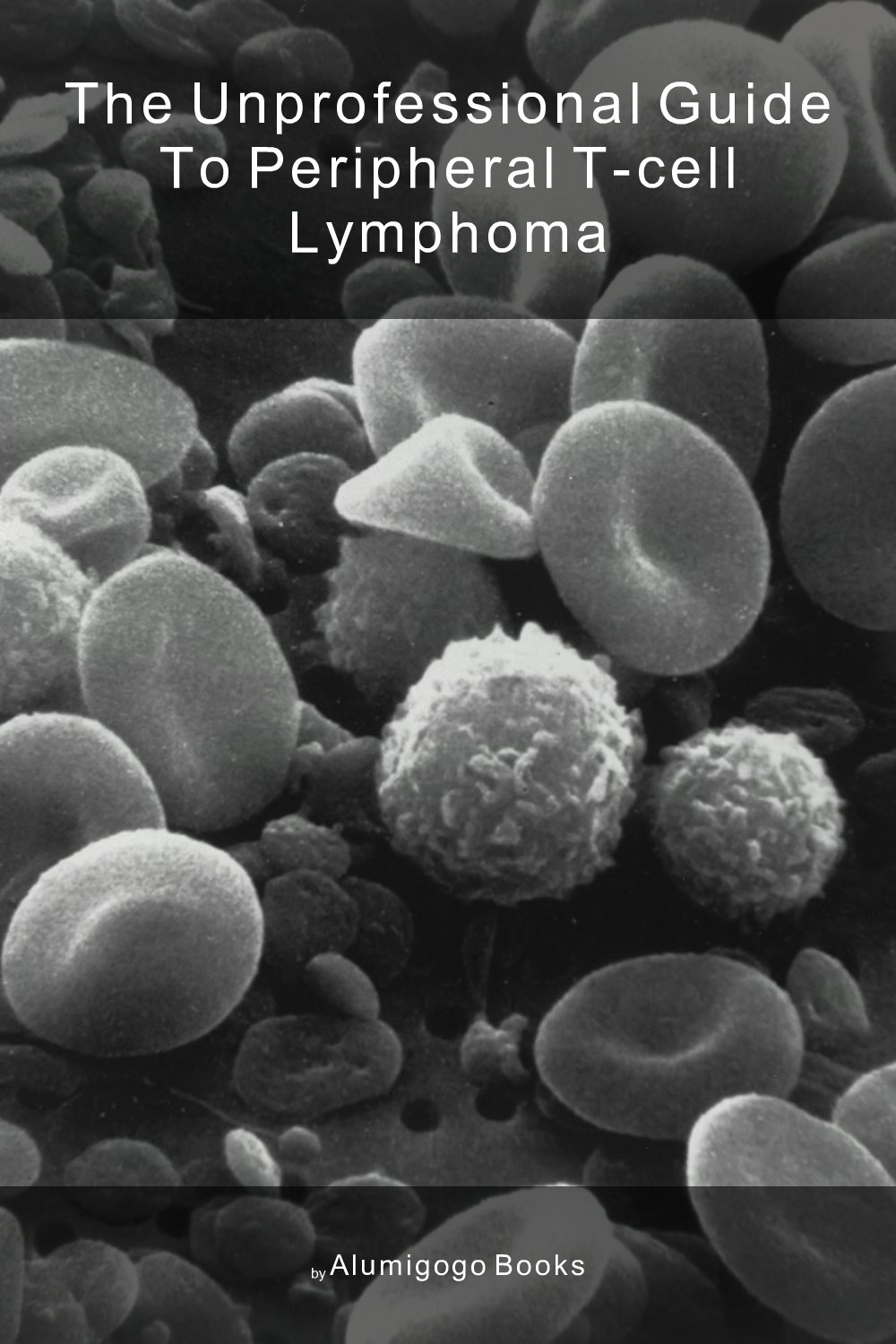 Cover of The Unprofessional Guide to peripheral T-cell lymphoma