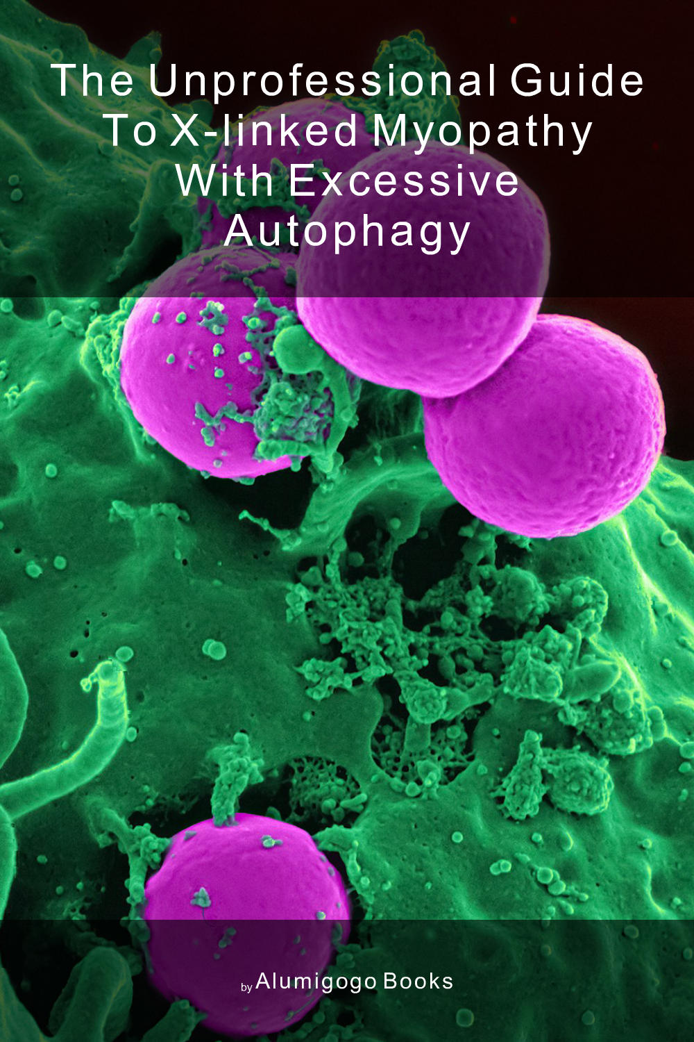 Cover of The Unprofessional Guide to X-linked myopathy with excessive autophagy