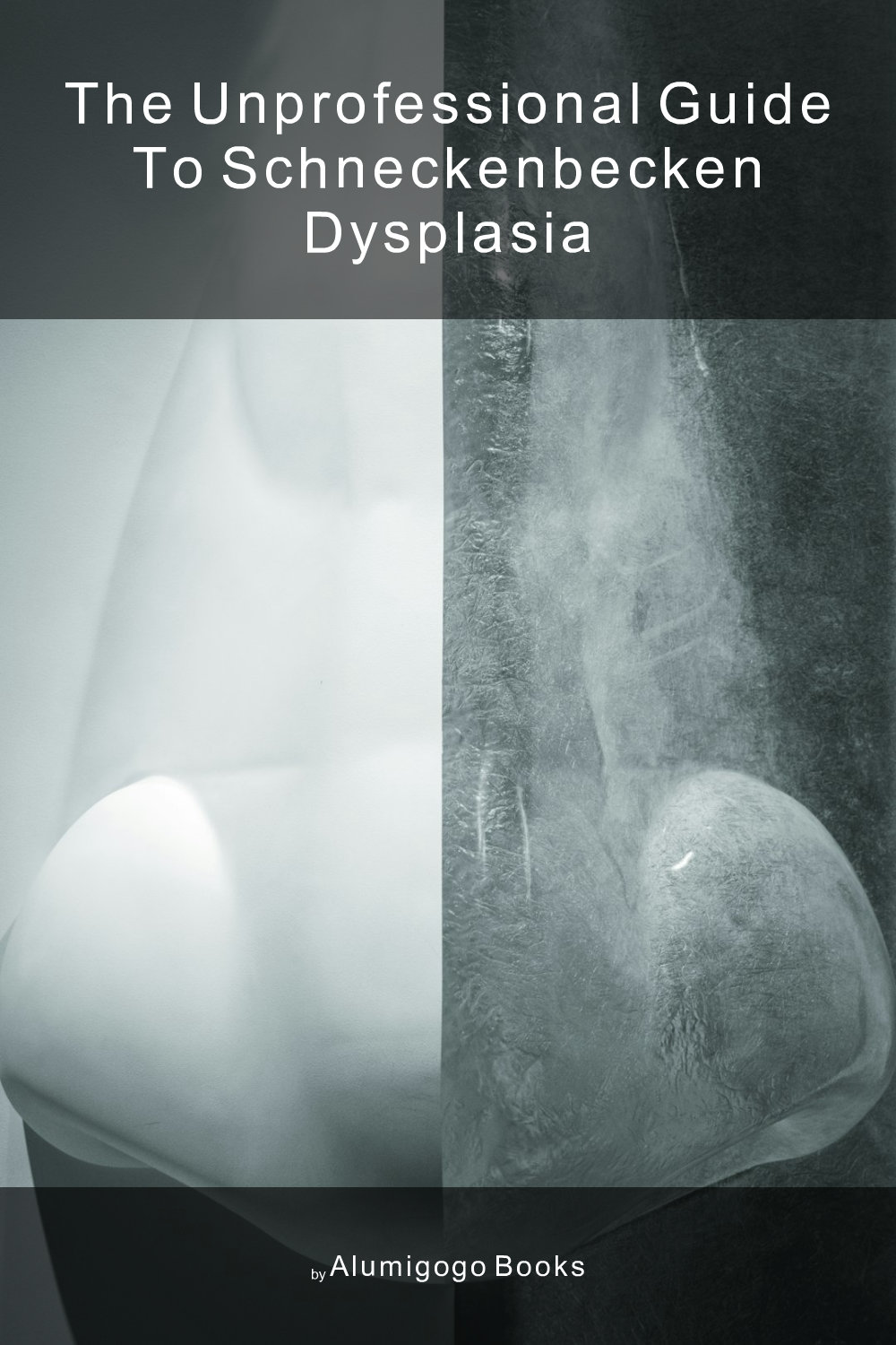 Cover of The Unprofessional Guide to schneckenbecken dysplasia