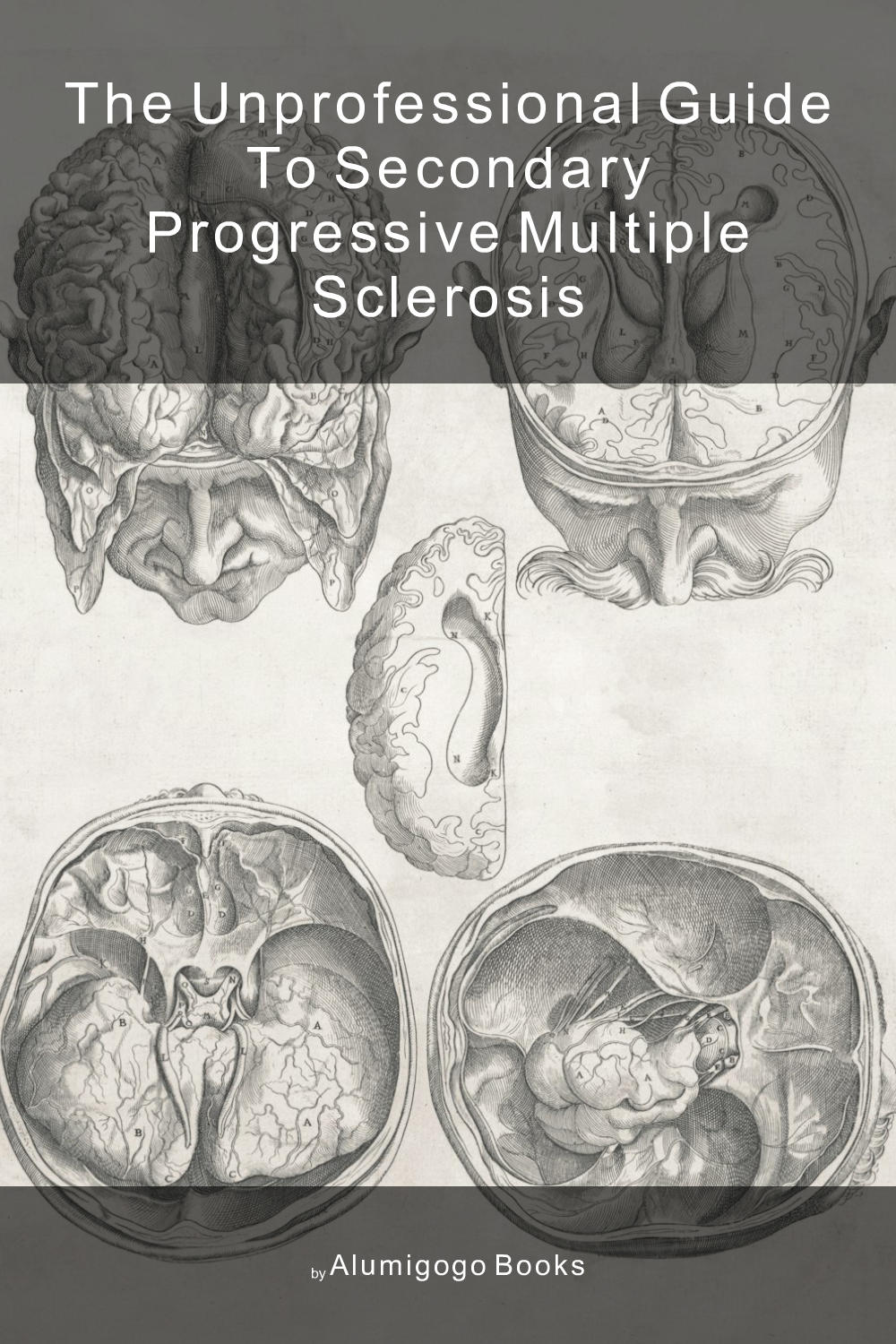 Cover of The Unprofessional Guide to secondary progressive multiple sclerosis