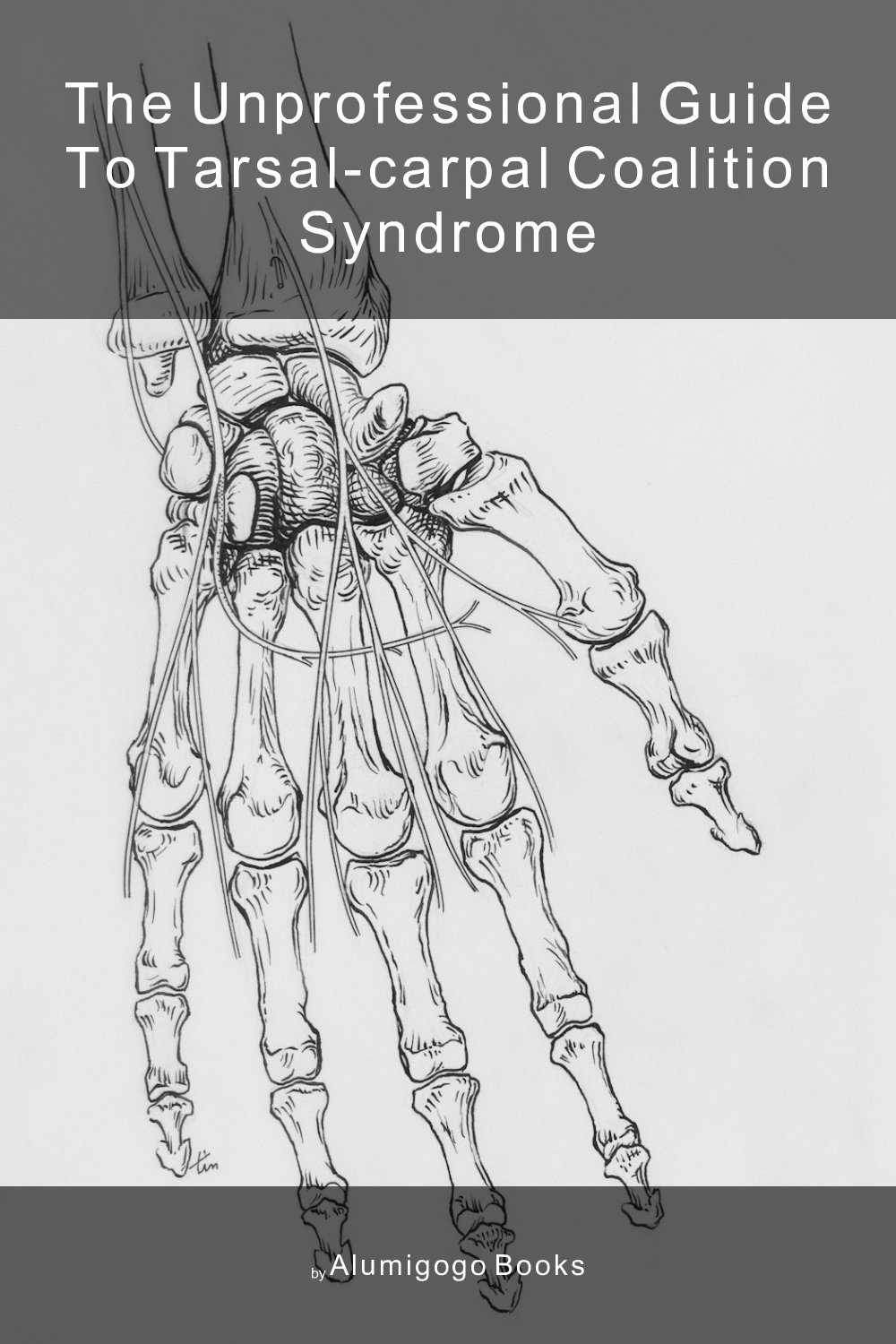Cover of The Unprofessional Guide to tarsal-carpal coalition syndrome