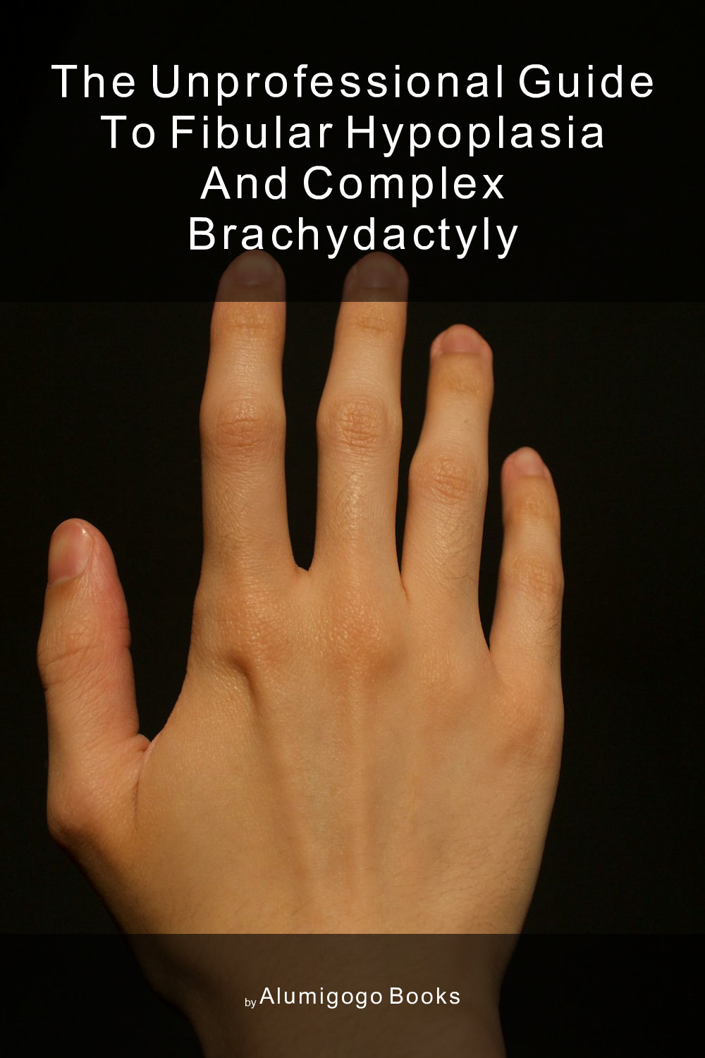 Cover of The Unprofessional Guide to fibular hypoplasia and complex brachydactyly