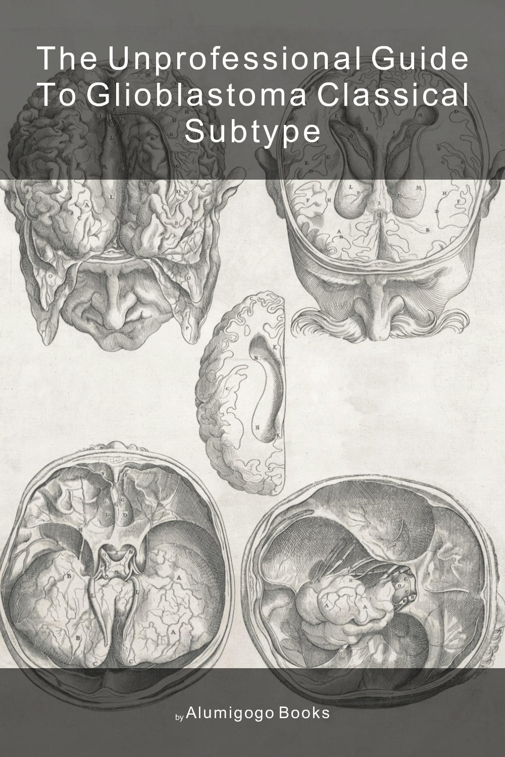 Cover of The Unprofessional Guide to glioblastoma classical subtype