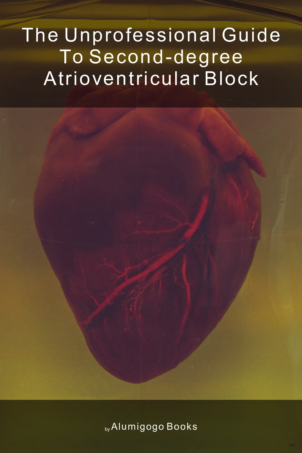 Cover of The Unprofessional Guide to second-degree atrioventricular block