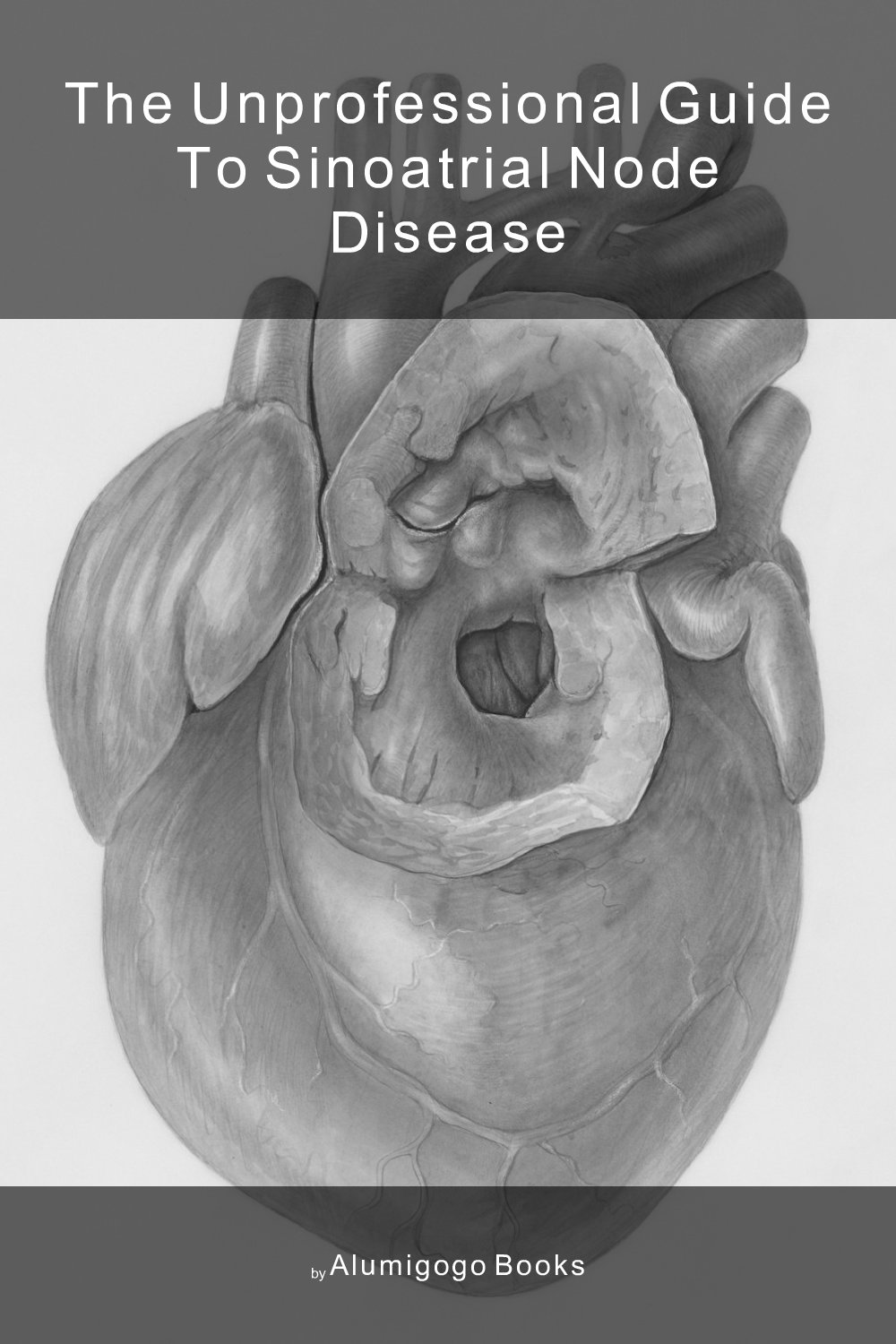 Cover of The Unprofessional Guide to sinoatrial node disease