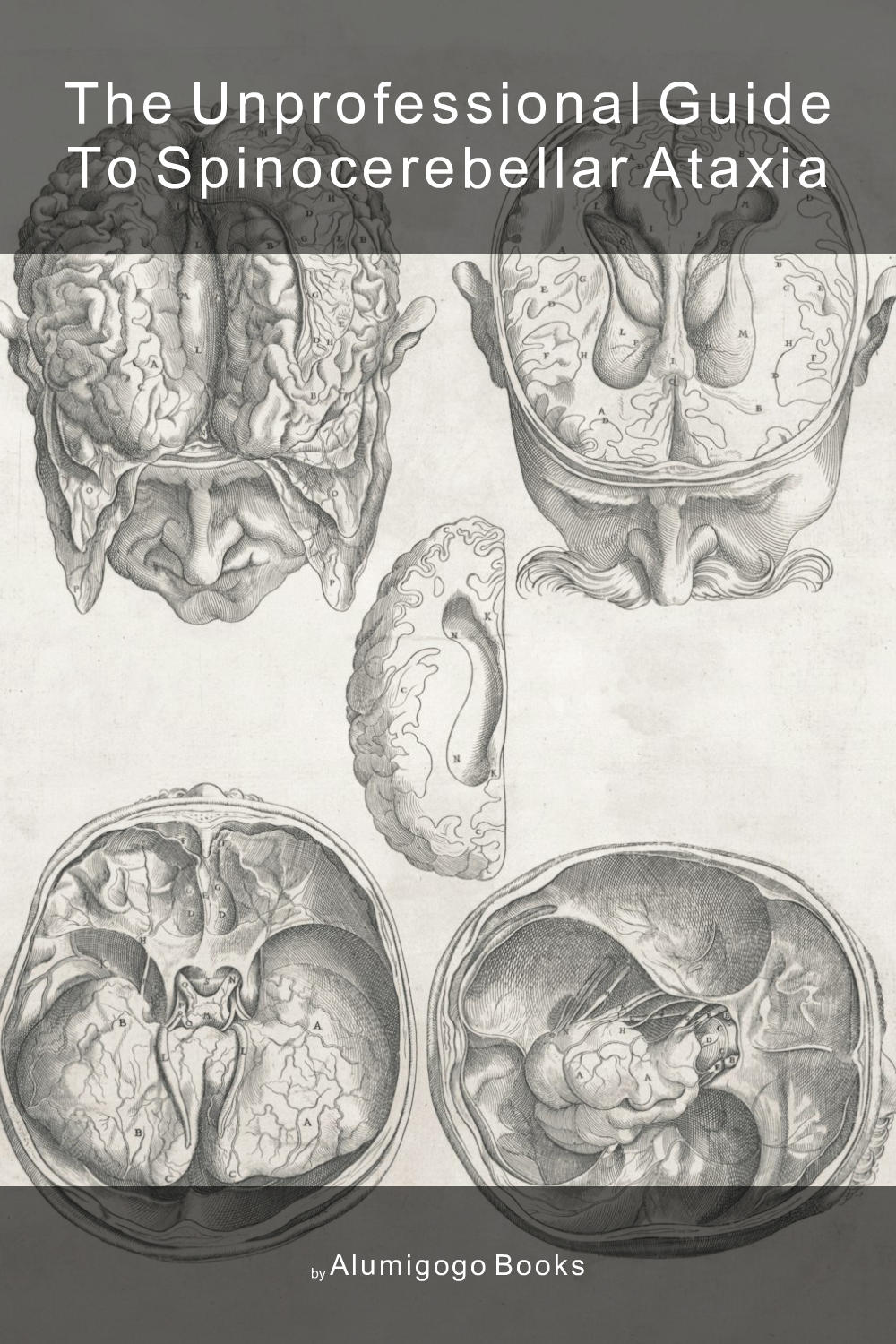 Cover of The Unprofessional Guide to spinocerebellar ataxia