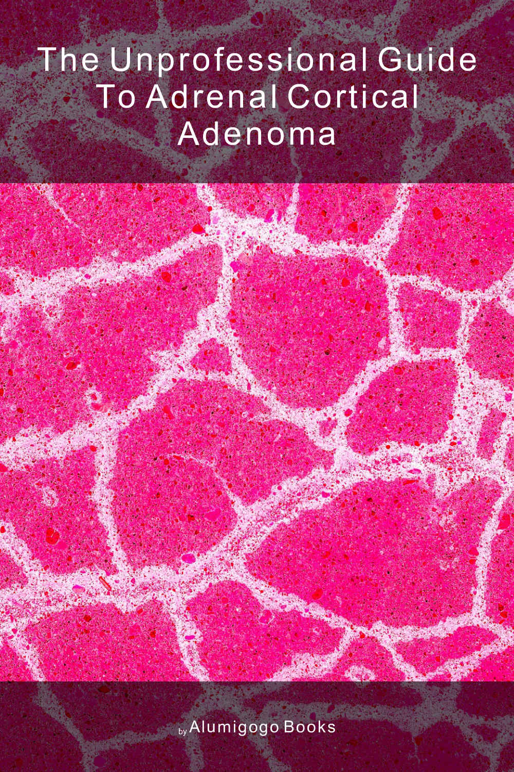 Cover of The Unprofessional Guide to adrenal cortical adenoma
