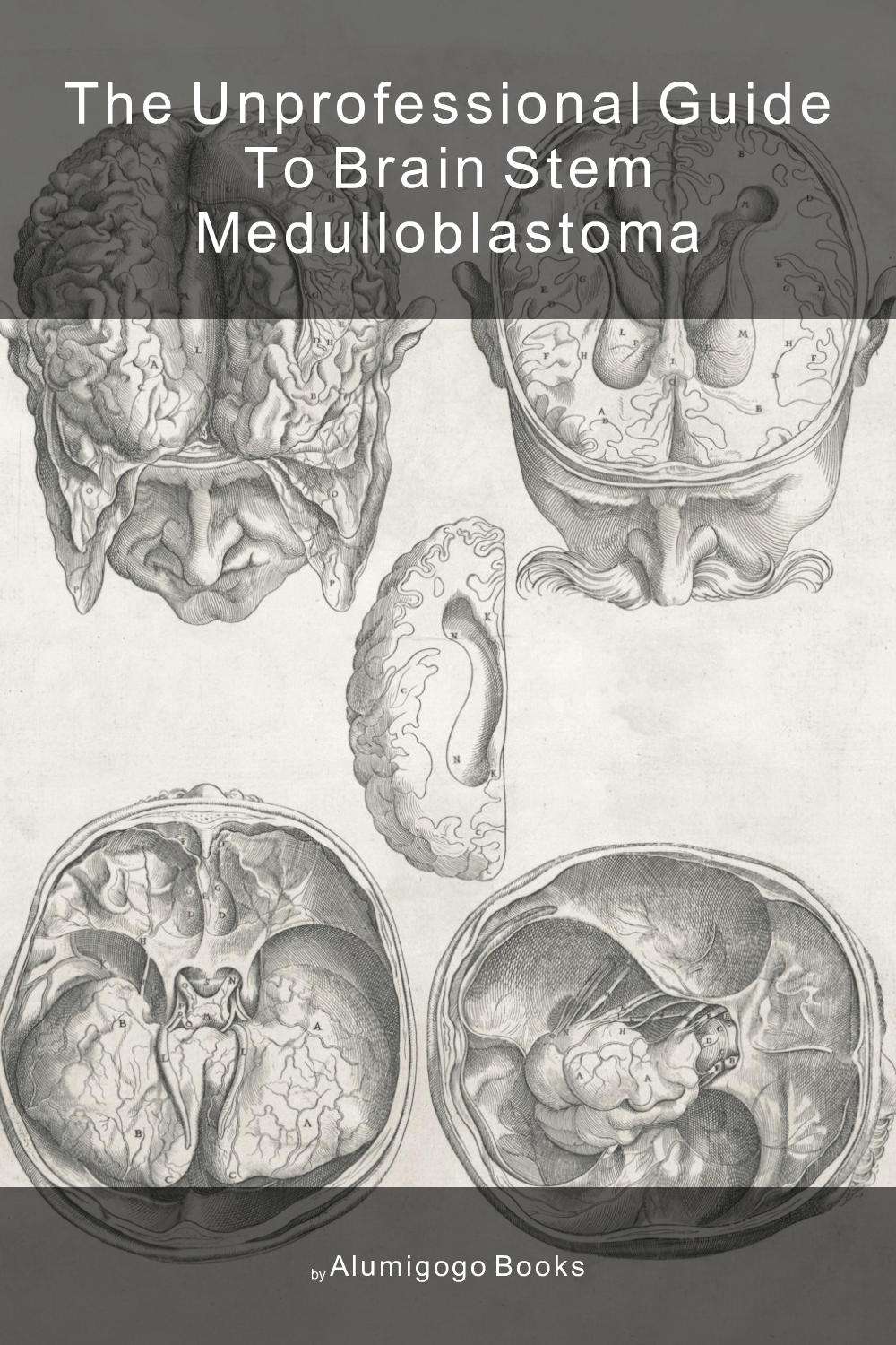 Cover of The Unprofessional Guide to brain stem medulloblastoma