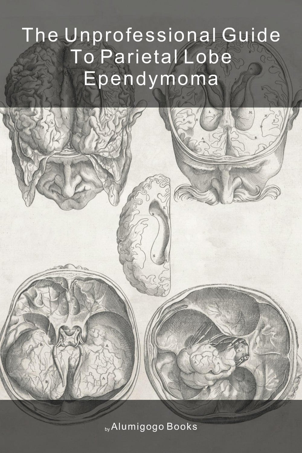 Cover of The Unprofessional Guide to parietal lobe ependymoma