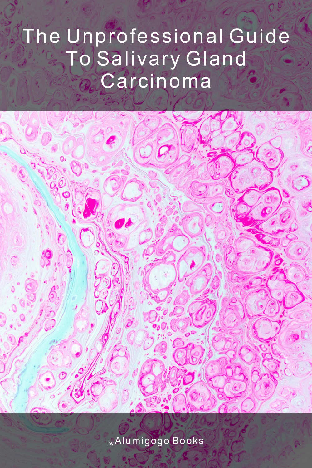 Cover of The Unprofessional Guide to salivary gland carcinoma