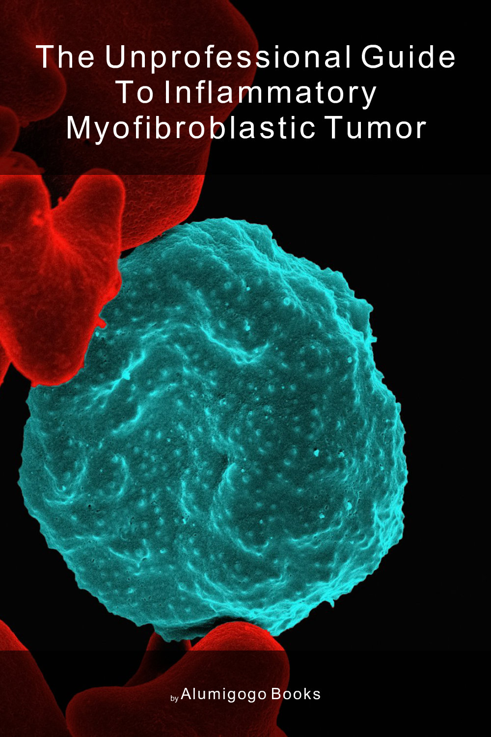 Cover of The Unprofessional Guide to inflammatory myofibroblastic tumor