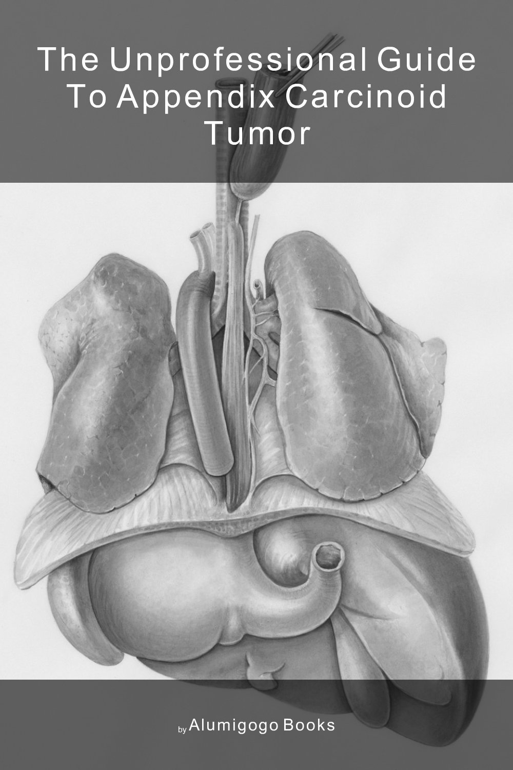 Cover of The Unprofessional Guide to appendix carcinoid tumor