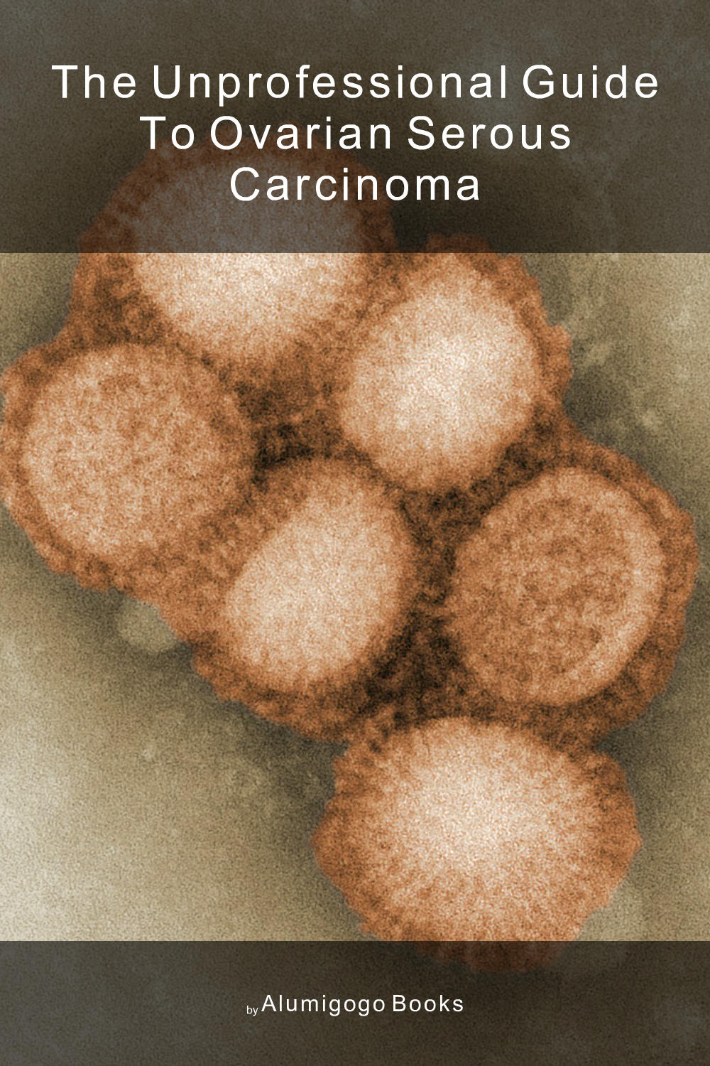 Cover of The Unprofessional Guide to ovarian serous carcinoma