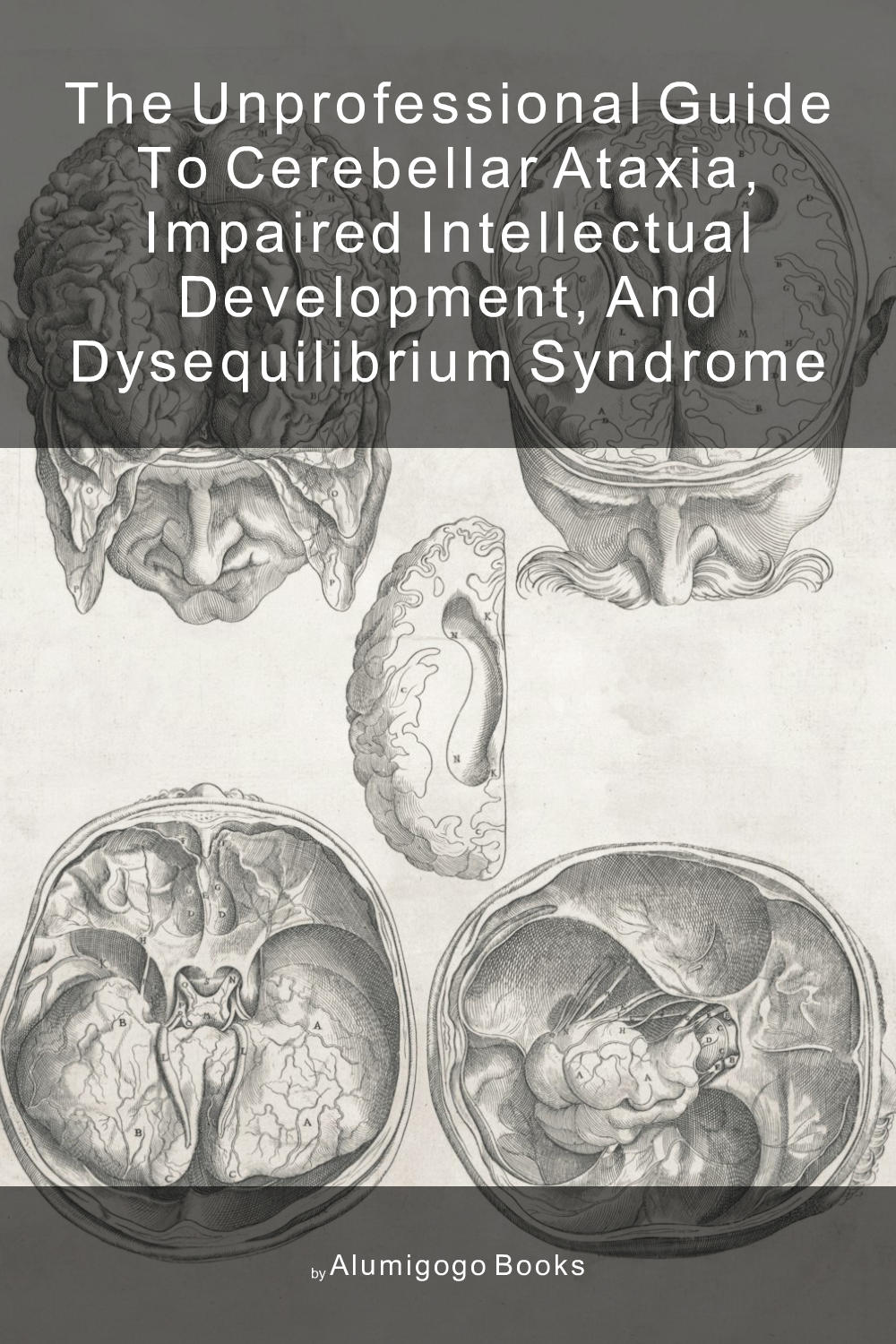 Cover of The Unprofessional Guide to cerebellar ataxia, impaired intellectual development, and dysequilibrium syndrome
