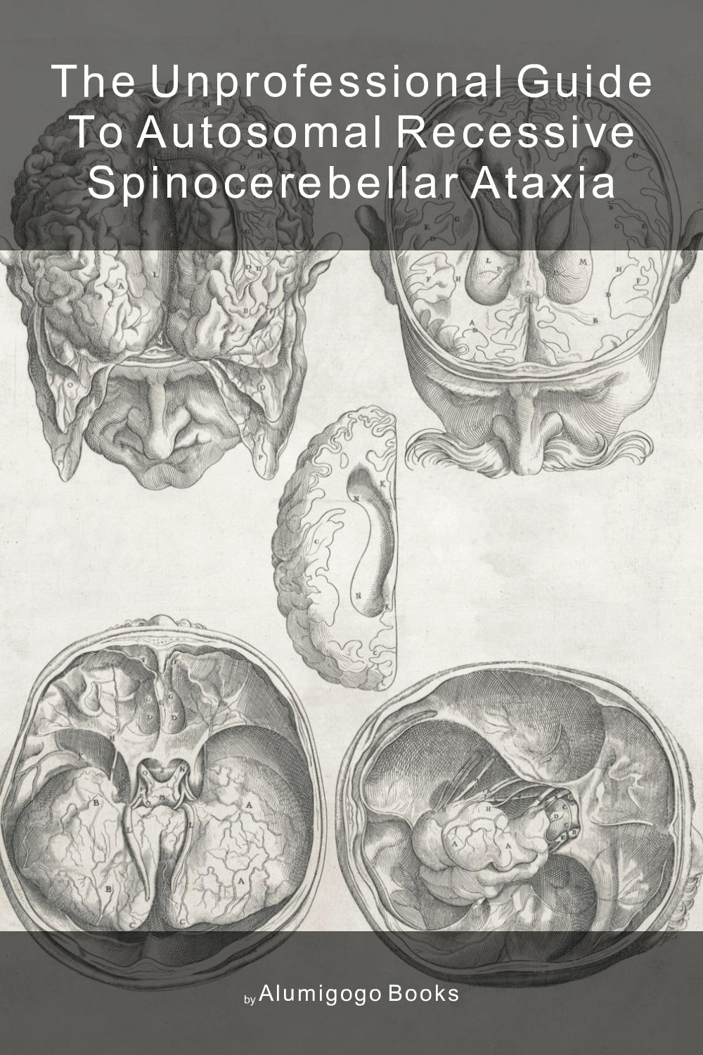 Cover of The Unprofessional Guide to autosomal recessive spinocerebellar ataxia