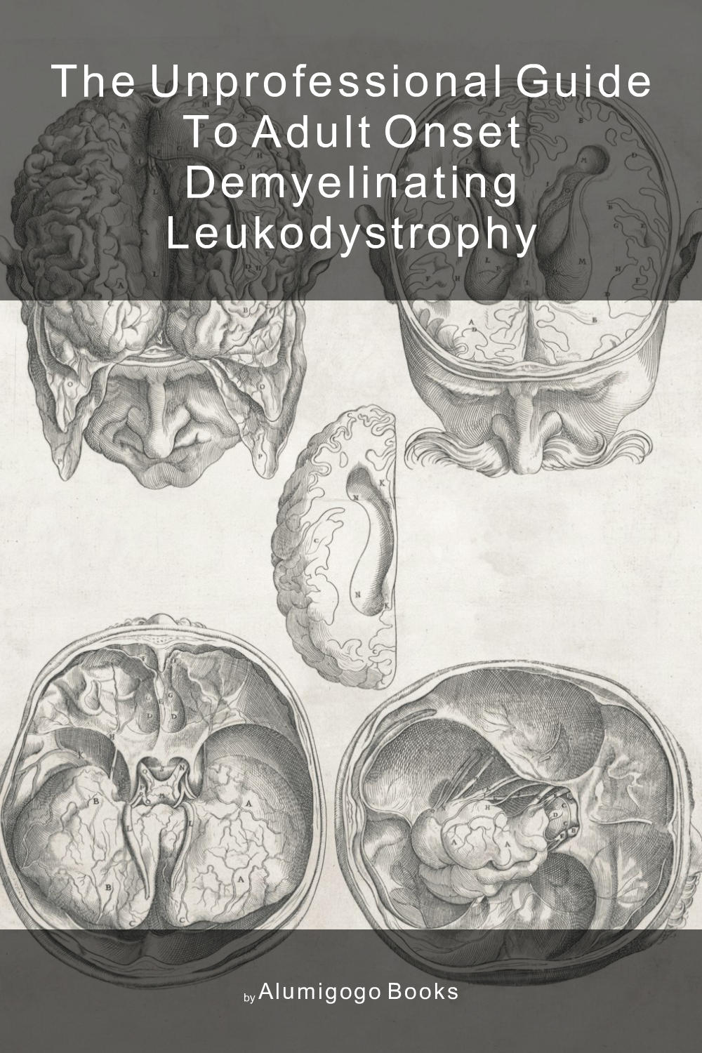 Cover of The Unprofessional Guide to adult onset demyelinating leukodystrophy