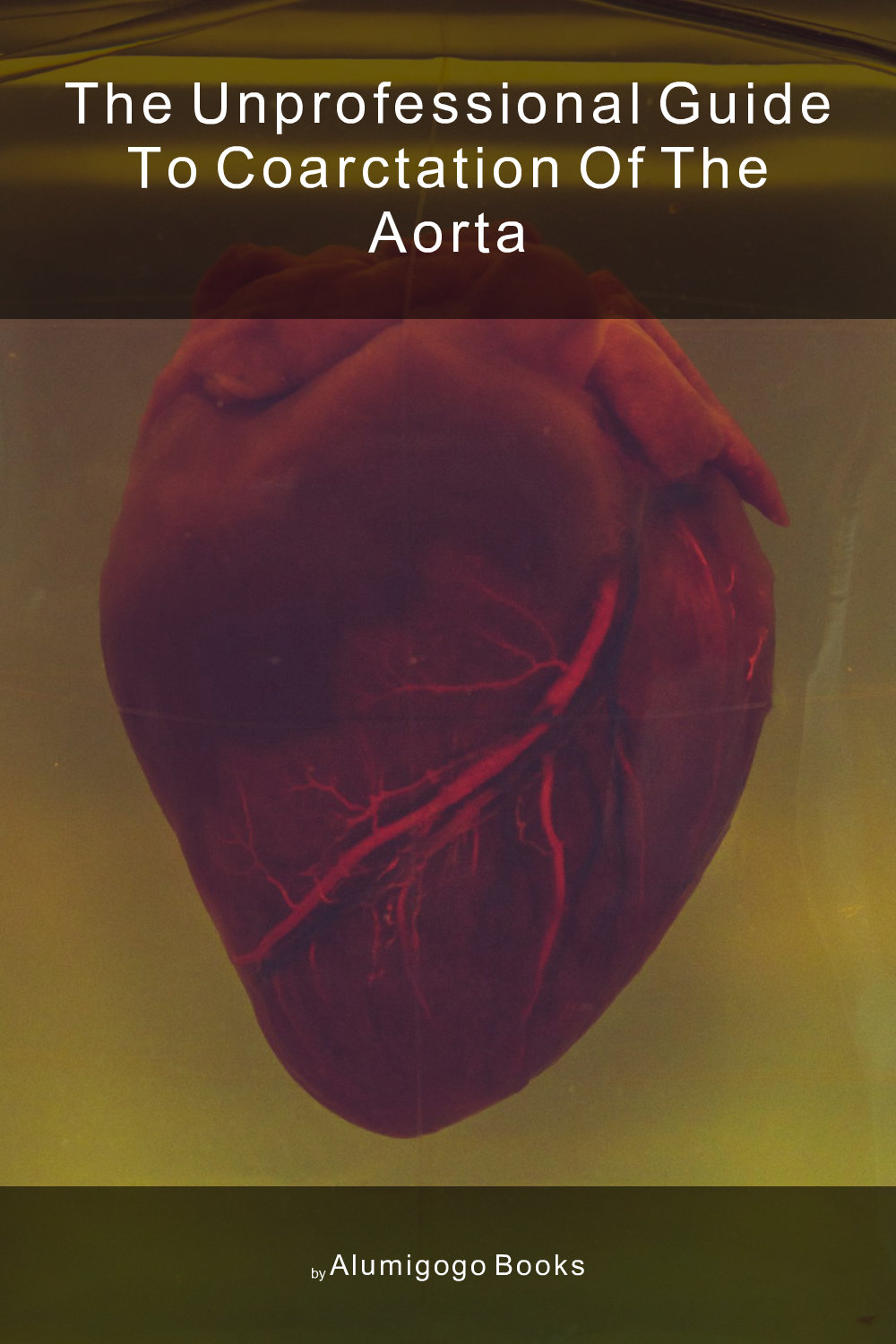 Cover of The Unprofessional Guide to coarctation of the aorta